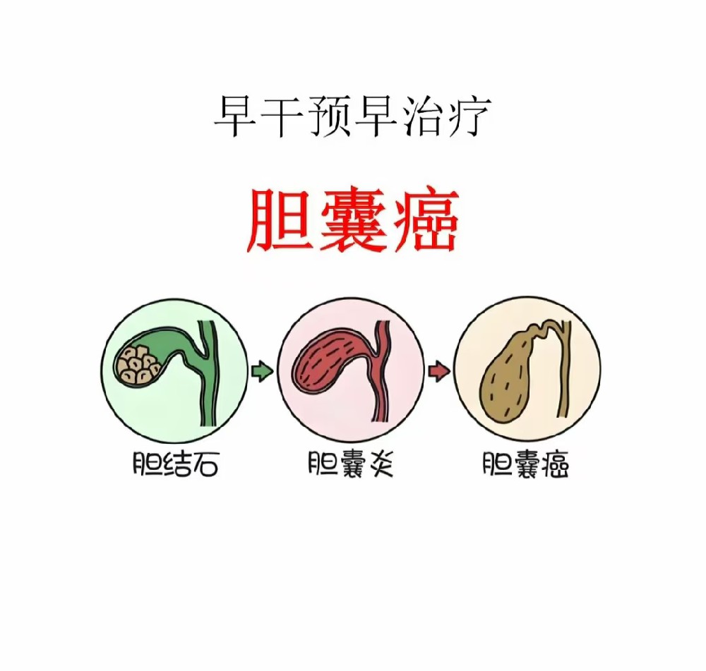 903d89f2ea74aa1fe1f52d8b121caf21.jpg