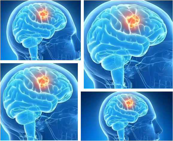 625368e0-e443-4672-8ab8-b85ed958af8e.png