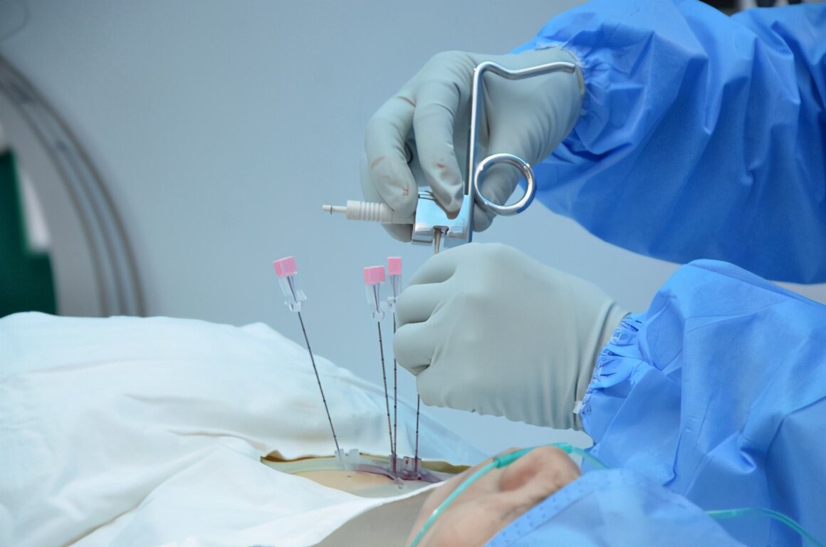 seedssurgery.JPG