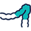 Colon Cancer