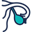 Ovarian Cancer